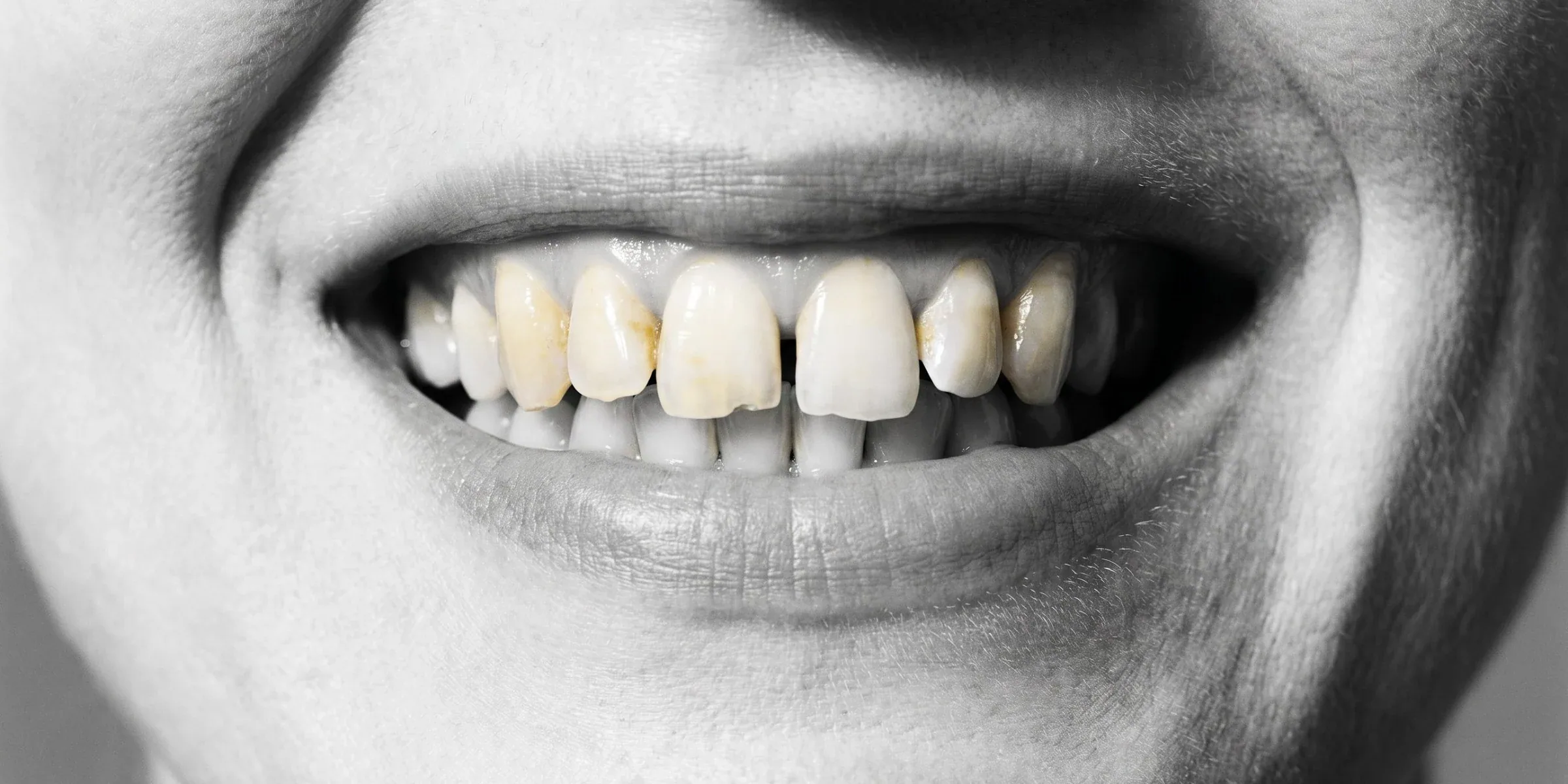 Illustration: smile before treatment